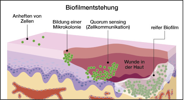 Biofilmentstehung: Vom Anheften der Zellen über Mikrokolonien bis zum reifen Biofilm