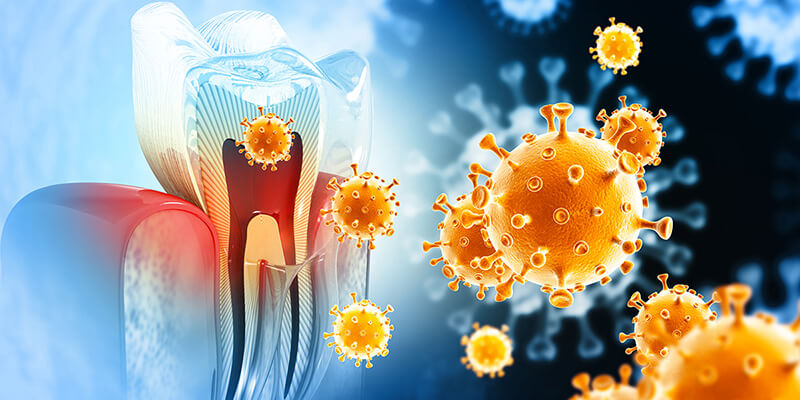 Darstellung eines Zahns mit pathogenen Bakterien am Zahnfleischrand